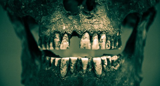 Skull