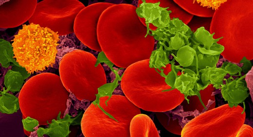 Human blood with red blood cells, T cells (orange) and platelets (green)